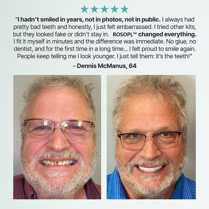 Cheeroll®Custom-Fit Dentures ⏰ ENDS TODAY • 70% OFF | Smile with Confidence