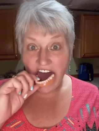 Strong Suction Full Denture for Confident Smile